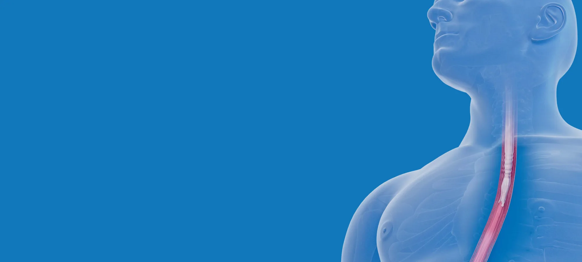 Illustration of esophageal inflammation